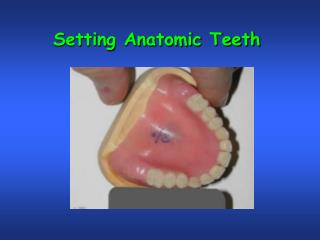  Setting Anatomic Teeth 