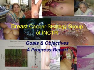  Bosom Cancer Strategy Group of INCTR 
