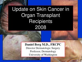  Daniel Berg M.D., FRCPC Director Dermatologic Surgery Professor, Dermatology University of Washington 
